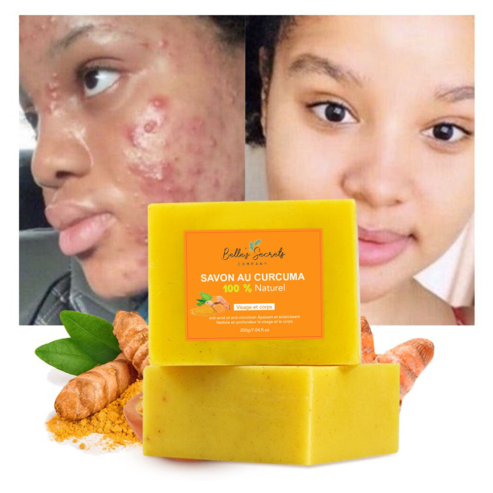 Savon au Curcuma et Vit C